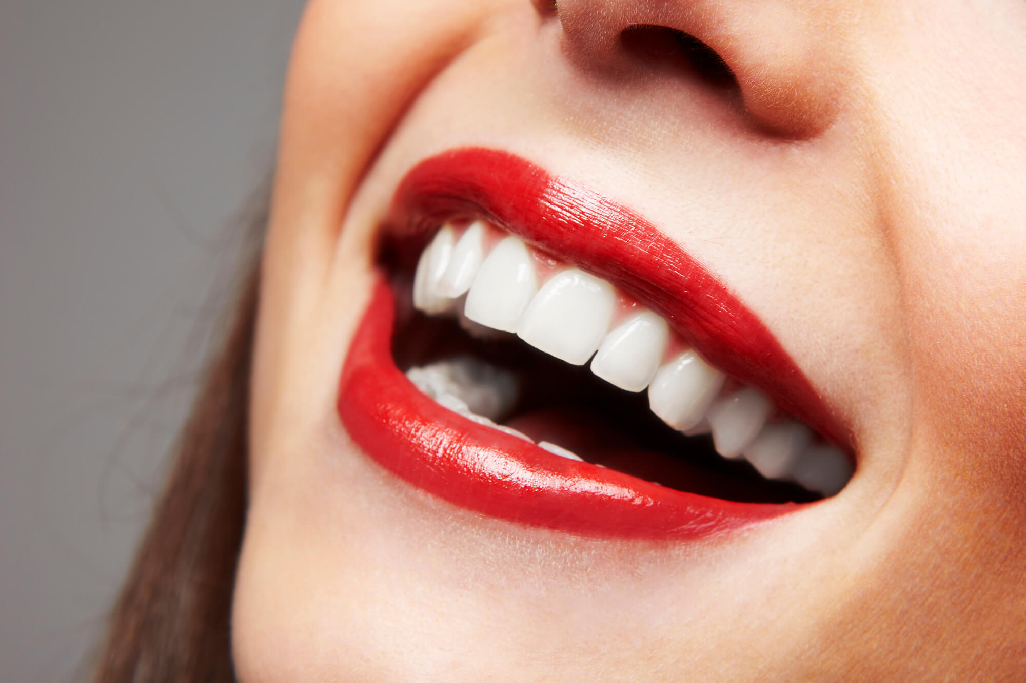 where can I get the best veneers greenville sc?
